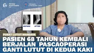 Pengalaman Pasien Pengapuran Lutut Melakukan Operasi Ganti Lutut di kedua Kaki | dr. Ardi S,Sp.OT(K)