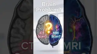 Brain Problem? CT Scan or MRI Scan &ndash; Which Is Better?