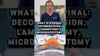 Explaining- Spinal Decompression, Laminectomy, Microdiscectomy