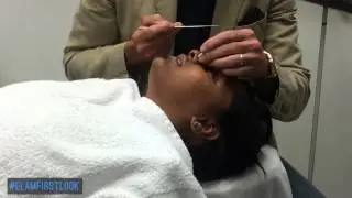 Minor Rhinoplasty (Nose Job) Surgery for Self-Improvement, Dr. Michael Elam #Elamfirstlook