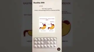 Ranitin 300mg tablet|Ranitidine 300 mg|Antacid,stomach Ulcer|Uses & side effects|Medico Pharmacist