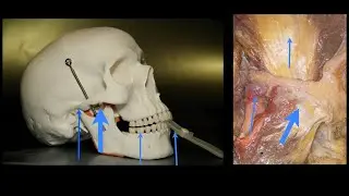 Did those patients experience TMJ pain after altering the vertical dimension?