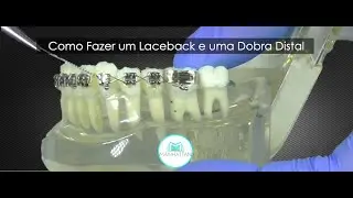 Como Fazer um Laceback em Ortodontia