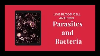 Parasites and bacterias in Live Blood!