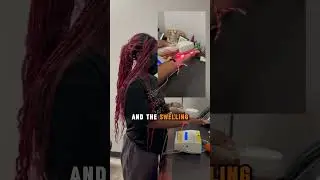 Laser Light Therapy On Injured Hand