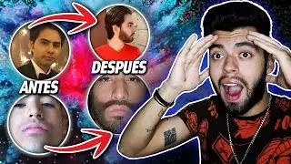 BARBAS INCREIBLES de MINOXIDIL!!