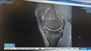 New surgery could reduce recovery time for common injury