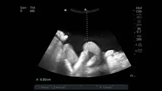 Ultrasound-Guided Procedures for Family and Internal Medicine-Sample
