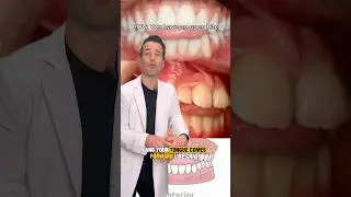 Исправить открытый прикус #стоматолог