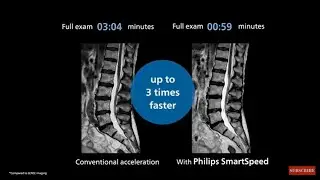 Philips SmartSpeed. No Compromise. Image quality and speed at your fingertips.