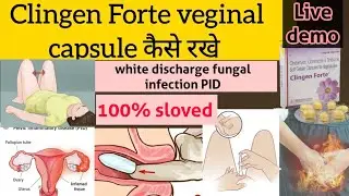 How to keep Clingen Forte vaginal capsules!