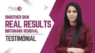 Patient Testimonial: Birthmark Removal Performed by Our Dermatologist