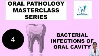OP 4 Bacterial Infections of Oral Cavity Explained | Oral Pathology #oralpatho #oralpathology #afk