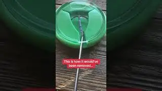 Are your IUD strings missing? This is how it would&rsquo;ve been removed