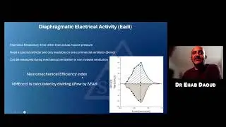 Assessing And Measuring Patients Effort During Mechanical Ventilation
