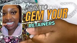 DIY PROJECT: Tooth Gems on Retainers