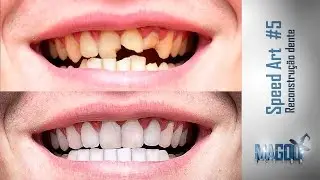 Photoshop - Arrumando os Dentes