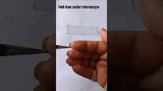 Nail Dust under Microscope 🦠#shorts #microscope #nails #germs #biology #experiment #viral