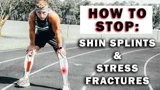 How to Prevent Shin Splints and Stress Fractures