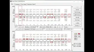 Eaglesoft - Patient Perio Chart