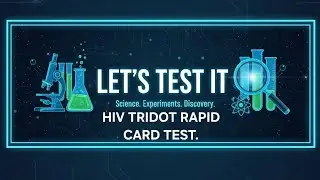 Hiv Tridot  rapid test . #labtechnician #labtechnologist #mbbs #neet 