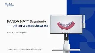 PANDA HAT Scanbody|All-on-X Cases Showcase