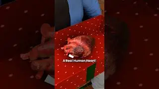 На Рождество он нашёл человеческое сердце! 🤯