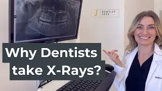 Why do DENTISTS take X-RAYS? | 12 Reasons for Dental X-Rays