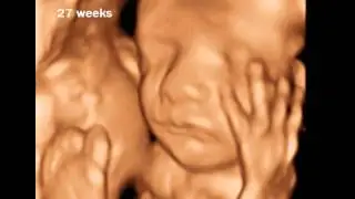 27 Weeks Pregnant - 3D Ultrasound Gallery