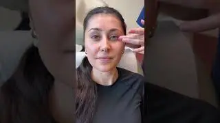 Lower Eyelid Massage - Post Operative Instruction