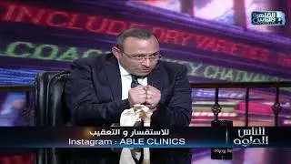 الناس الحلوة | فنيات علاج مشاكل مفصل الكتف مع دكتور عماد مجدي روفائيل