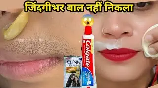 डॉक्टर ने बताया👉बिना किसी दर्द चेहरे के बाल हटाने का ये दो बूंद लगते ही हैरान हूं😱|| facial hair