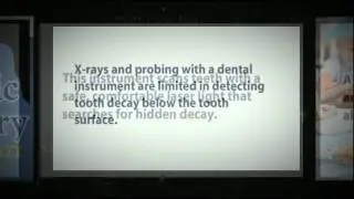 Pediatric Dentist in Castle Rock May2012