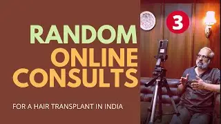 Hair Transplant in India by Dr Bhatti | Random Consultation with Best Doctor