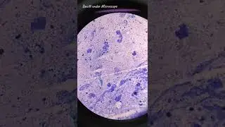 Mycobacterium tuberculosis🔬 #medtechstudent #medtechlife #medtech