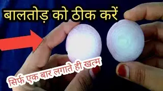 बालतोड़ पर एक बार लगाते ही खत्म करे// baaltod ka ilaj