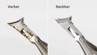 Aufbereitung von Instrumenten mit Ablagerungen/Einbrennungen