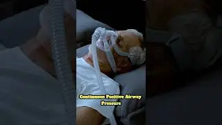 How a CPAP machine helps with sleep apnea #sleepapnea #sleeping #cpaptherapy