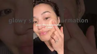 glowy skin transformation in less than 7 days #skincare #skintransformation