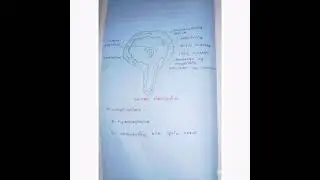 CSF Circulation 📖#medicalnotes #handwrittennotes #physiology #neuro