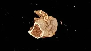 17 December 2025 - Lund University Bioimaging Centre - Christmas Calendar 2025