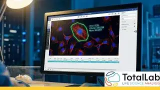 Phoretix Toolbox Demo: Precision Image Quantification for Scientists | Advanced Analysis Software