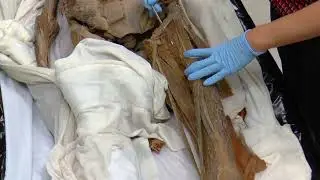 Anatomy: Muscles of the anterior compartment of the thigh (Prone Cadaver)