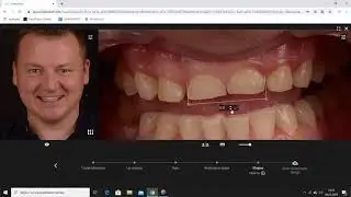Digital Workflow Jadent Smile Design