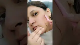 Try tinkle razor for face shaving #tinklerazor #faceshave #skincaretips #facialhairremovalathome