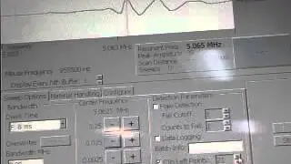 40 micron defect