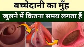 बच्छेदानी का मुँह खुलने में कितना समय लगता हैं|exercises to turn baby head down|