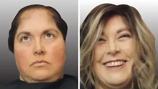 Woman Extreme Makeover  HAIR REPLACEMENT SYSTEM  #Shorts