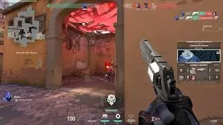 SEAN DEAGLE ACE OMG SOOOO POGGERS