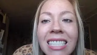 *Dentures at 30!* 8 week update!!